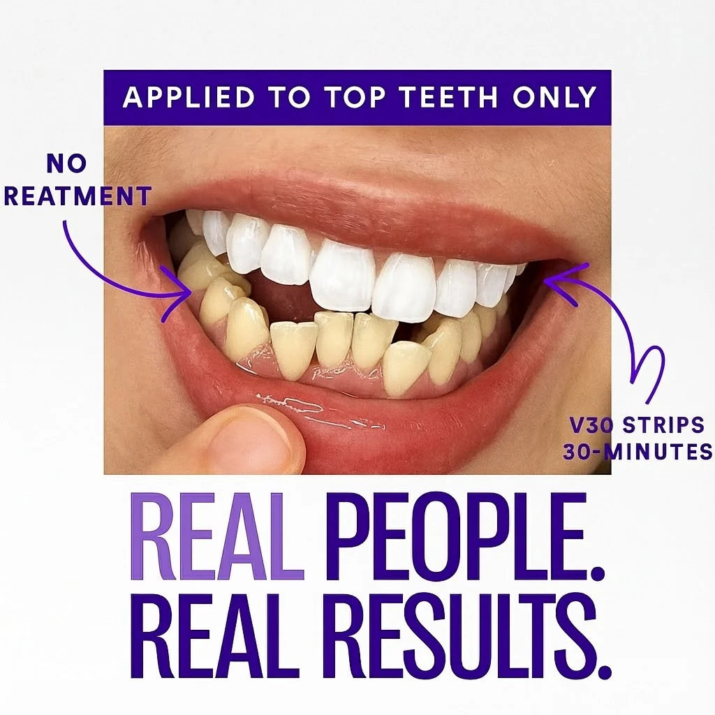 Dentley™ Purple Whitening Strips