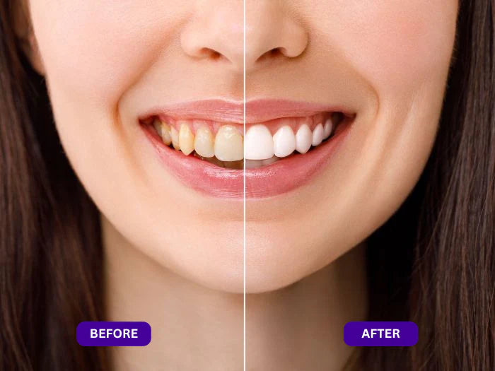 Unlock Your Confidence with a Brighter Smile
